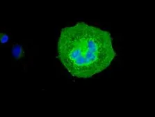 Anti-VMAT2 antibody [9E11] used in Immunocytochemistry/ Immunofluorescence (ICC/IF). GTX83635