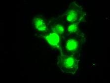 Anti-Melanoma gp100 antibody [8A4] used in Immunocytochemistry/ Immunofluorescence (ICC/IF). GTX83640