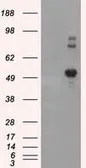 Anti-SIL1 antibody [3E3] used in Western Blot (WB). GTX83642