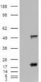 Anti-Shh antibody [10H6] used in Western Blot (WB). GTX83651