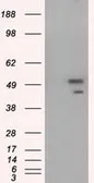 Anti-SHC1 antibody [1D3] used in Western Blot (WB). GTX83655