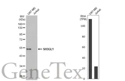 Anti-SH3GL1 antibody [2F5] used in Western Blot (WB). GTX83657