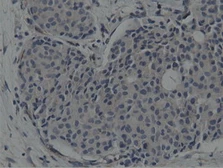 Anti-SH3GL1 antibody [3F8] used in IHC (Paraffin sections) (IHC-P). GTX83658