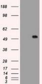 Anti-alpha 1 Antitrypsin antibody [11G2] used in Western Blot (WB). GTX83663