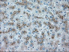 Anti-alpha 1 Antitrypsin antibody [15H10] used in IHC (Paraffin sections) (IHC-P). GTX83665