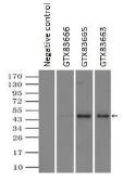 Anti-alpha 1 Antitrypsin antibody [15H10] used in Immunoprecipitation (IP). GTX83665