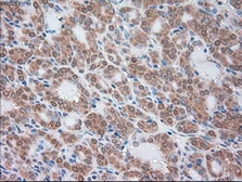 Anti-alpha 1 Antitrypsin antibody [9A1] used in IHC (Paraffin sections) (IHC-P). GTX83666