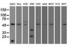 Anti-alpha 1 Antitrypsin antibody [9A1] used in Western Blot (WB). GTX83666