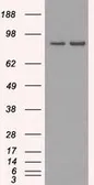 Anti-SCYL3 antibody [4F10] used in Western Blot (WB). GTX83676