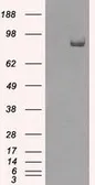 Anti-SATB1 antibody [6C6] used in Western Blot (WB). GTX83685