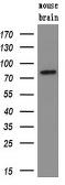 Anti-SAMHD1 antibody [1F9] used in Western Blot (WB). GTX83686