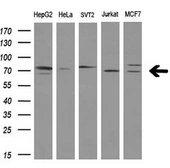 Anti-SAMHD1 antibody [1F9] used in Western Blot (WB). GTX83686