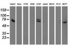 Anti-SAMHD1 antibody [1F6] used in Western Blot (WB). GTX83687