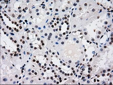 Anti-RPA32 antibody [8B3] used in IHC (Paraffin sections) (IHC-P). GTX83688