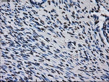 Anti-RPA32 antibody [1H10] used in IHC (Paraffin sections) (IHC-P). GTX83691