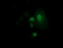 Anti-RND1 antibody [1C3] used in Immunocytochemistry/ Immunofluorescence (ICC/IF). GTX83708