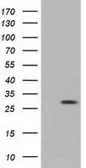 Anti-RND1 antibody [4F12] used in Western Blot (WB). GTX83709
