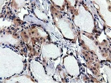 Anti-RBBP9 antibody [4G3] used in IHC (Paraffin sections) (IHC-P). GTX83717