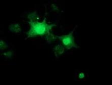 Anti-RBBP9 antibody [4G3] used in Immunocytochemistry/ Immunofluorescence (ICC/IF). GTX83717