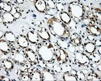Anti-RALBP1 antibody [6G10] used in IHC (Paraffin sections) (IHC-P). GTX83730