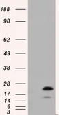 Anti-RAB17 antibody [4E7] used in Western Blot (WB). GTX83739
