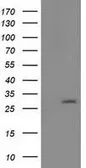 Anti-PYCRL antibody [2E10] used in Western Blot (WB). GTX83750