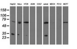 Anti-PYCR2 antibody [2F11] used in Western Blot (WB). GTX83754
