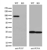 Anti-PUS7 antibody [4A2] used in Western Blot (WB). GTX83755