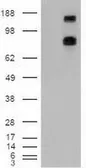 Anti-PTCH1 antibody [5c7] used in Western Blot (WB). GTX83771