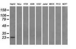 Anti-PSMD10 antibody [3F6] used in Western Blot (WB). GTX83773