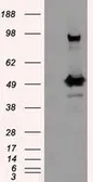 Anti-PSMC3 antibody [1C10] used in Western Blot (WB). GTX83784