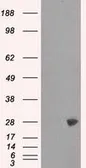 Anti-PSMA7 antibody [8F9] used in Western Blot (WB). GTX83785