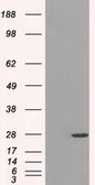 Anti-PSMA7 antibody [2A7] used in Western Blot (WB). GTX83786