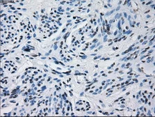 Anti-Prolactin antibody [6B1] used in IHC (Paraffin sections) (IHC-P). GTX83802