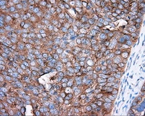 Anti-PKA R2 antibody [4A3] used in IHC (Paraffin sections) (IHC-P). GTX83825