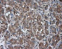 Anti-PKA R2 antibody [1B4] used in IHC (Paraffin sections) (IHC-P). GTX83826