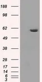 Anti-PPP5C antibody [2E12] used in Western Blot (WB). GTX83832