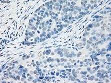 Anti-PPP5C antibody [3G1] used in IHC (Paraffin sections) (IHC-P). GTX83836