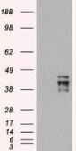 Anti-Oct4 antibody [9B7] used in Western Blot (WB). GTX83850