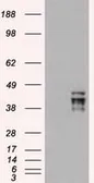 Anti-Oct4 antibody [9B7] used in Western Blot (WB). GTX83850