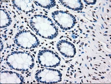 Anti-PLK1 antibody [1D4] used in IHC (Paraffin sections) (IHC-P). GTX83865
