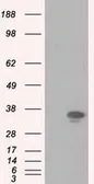 Anti-PIM2 antibody [5D5] used in Western Blot (WB). GTX83887