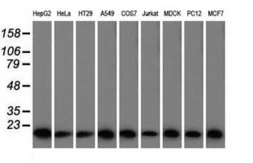 Anti-Profilin 1 antibody [2D2] used in Western Blot (WB). GTX83902