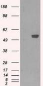 Anti-PFKFB4 antibody [1C8] used in Western Blot (WB). GTX83904