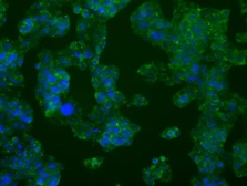 Anti-PFKFB4 antibody [1C8] used in Immunocytochemistry/ Immunofluorescence (ICC/IF). GTX83904
