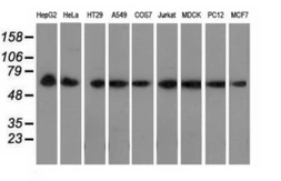 Anti-PEX5 antibody [6E9] used in Western Blot (WB). GTX83905