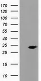Anti-PECR antibody [1E4] used in Western Blot (WB). GTX83911