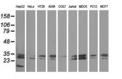 Anti-PECR antibody [2B2] used in Western Blot (WB). GTX83913