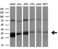 Anti-PECR antibody [1C9] used in Western Blot (WB). GTX83914