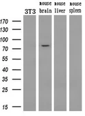 Anti-PDE10A antibody [1B2] used in Western Blot (WB). GTX83931